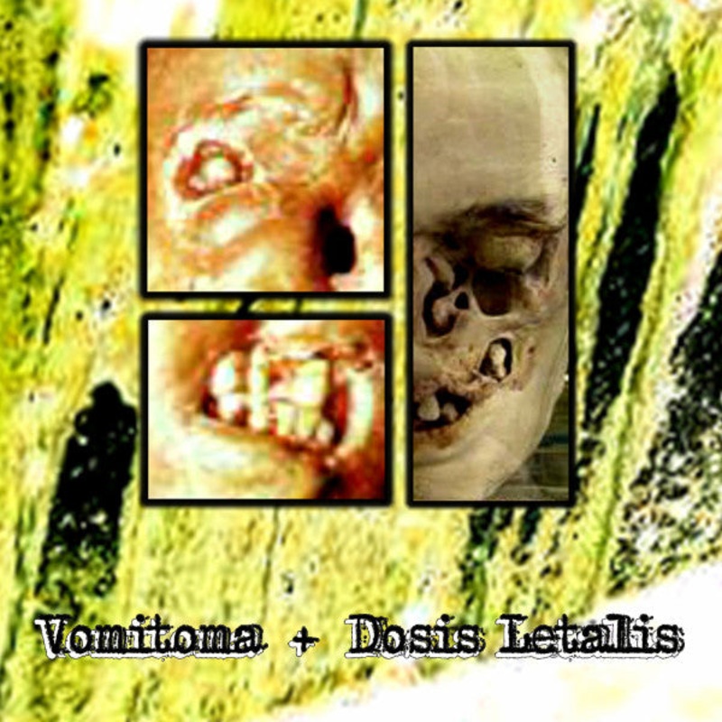 Vomitoma + Dosis Letalis  Painting The Walls With Vomit Cassette